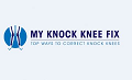 My Knock Knee Fix